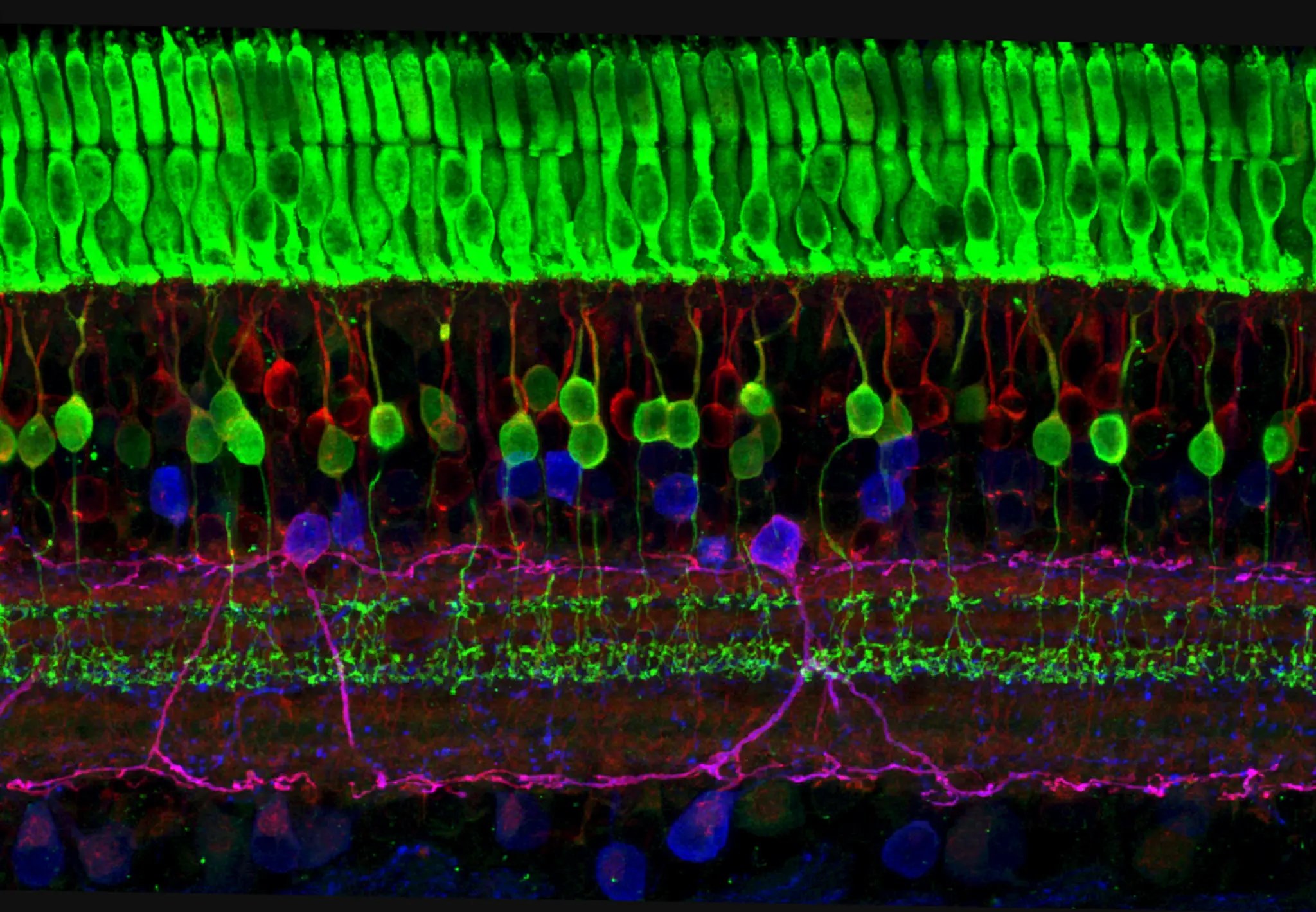 Retina target for advanced therapy medicinal products ATMPs